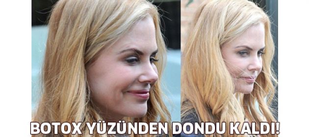 Nicole Kidman da botox mağdurları arasına katıldı