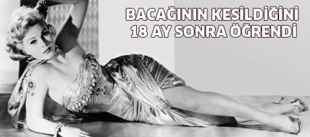 Efsane oyuncu, bacağının kesildiğini 18 ay sonra öğrendi