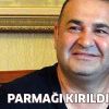 Şafak Sezer'in parmağını kırdı!