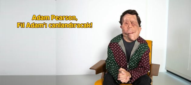 Adam Pearson, Fil Adam'ı canlandıracak!